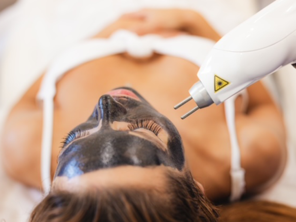 Πλεονεκτήματα του Hollywood- carbon Laser Peel